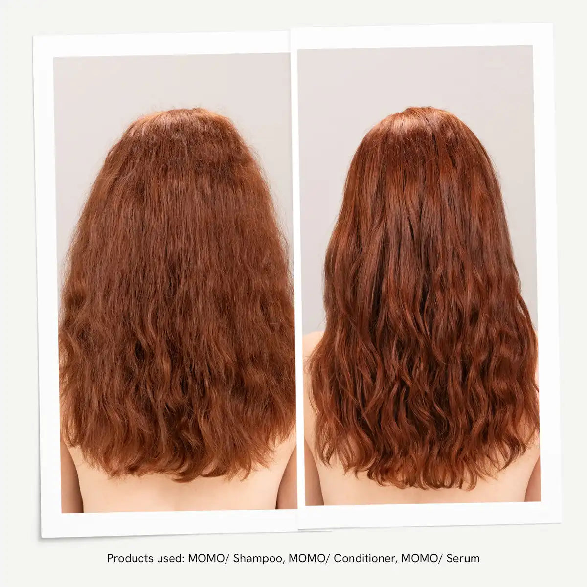MOMO Serum Secondary image